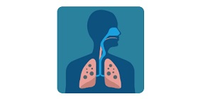 Tuberculosis Susceptibility