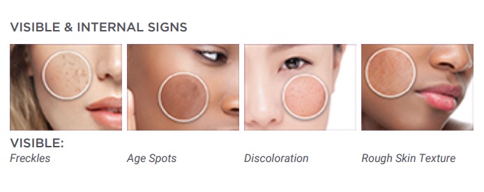 The visible signs of pigmentation.