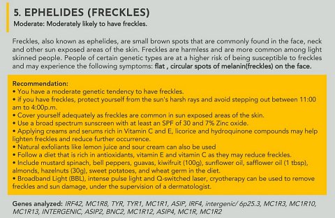 My result for freckles.