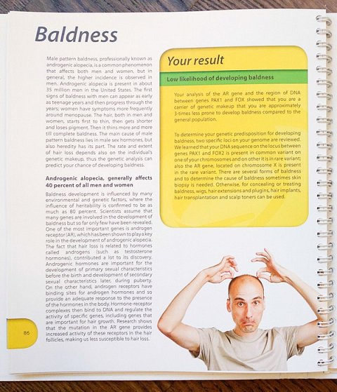 My baldness result.
