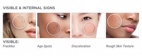 The visible signs of pigmentation.